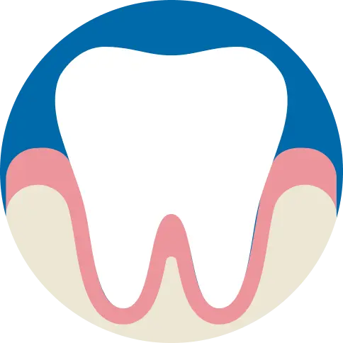 Healthy tooth and gums