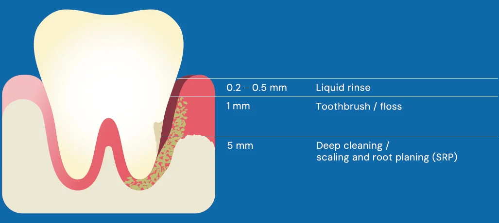 tooth image