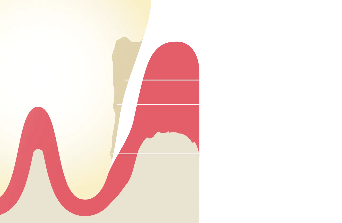 Chart showing severity of pocket depth infection at various millimeter depths