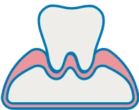 Red or swollen gums